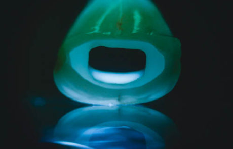 Perfekte 'Fälschungen' von Zähnen - wie gewachsen. Willi's Glas - SEINE Innovation.