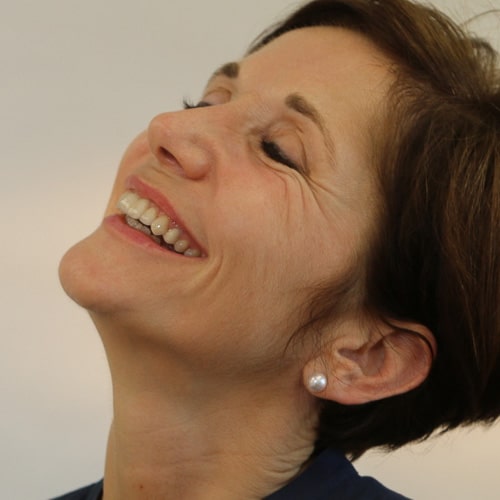 Veneers