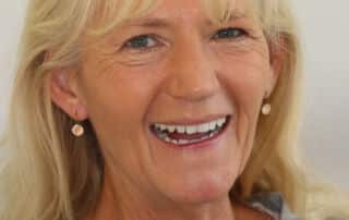 Oberkiefer- und Unterkiefervollprothesen 8 Oberkiefer- und Unterkiefervollprothesen